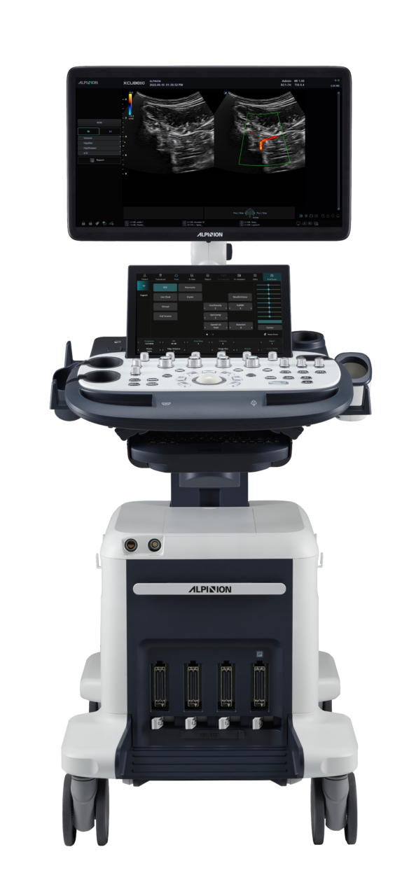XC60 front MSK - Prometheus Medical